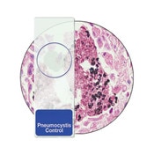 Pneumocystis Control Slides